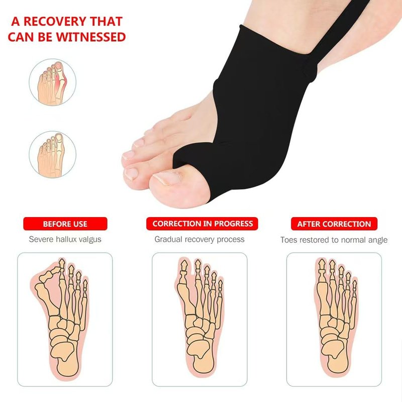 ZXCFBEA 2PCS Bunion Corrector for Women & Men,Big Toe Separators-Bunion Splint-Bunion Pads-Hammer Toes Straightener-Toes Spacers Pain Relief, Comfortable & Breathable for Day/Night (Black)