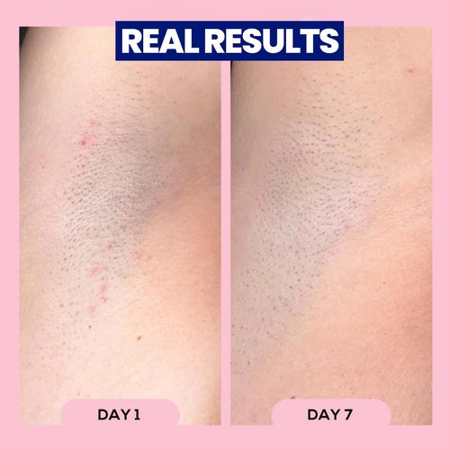 Megababe Après Shave Roll-On Treatment - Post-Shave & Waxing Care for Ingrown Hairs | 3.0 fl oz