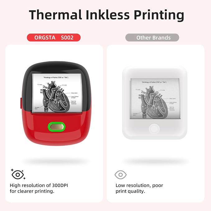 ORGSTA Sticker Printer, 300 DPI Ultra-Clear Mini Portable Sticker Maker