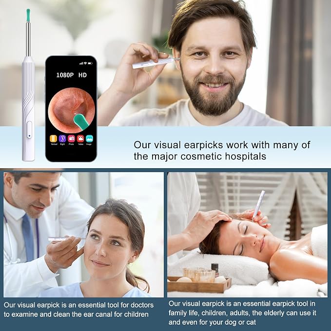 Ear Wax Removal Tool, Ear Cleaner with1080P HD Otoscope Camera, Ear Camera