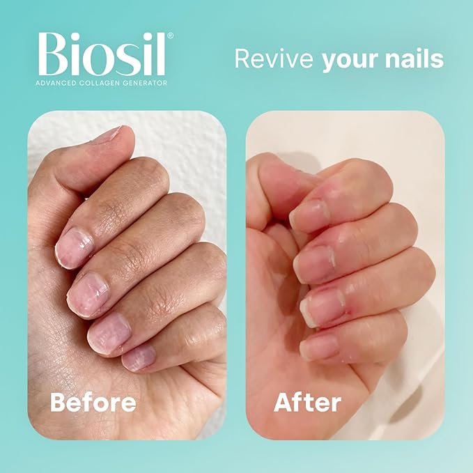 Biosil Collagen Generator - 60 Original Capsules, Pack of 2 - with Patented ch-OSA Complex - Generates & Protects Your Own Collagen - GMO Free - 60-Day Supply