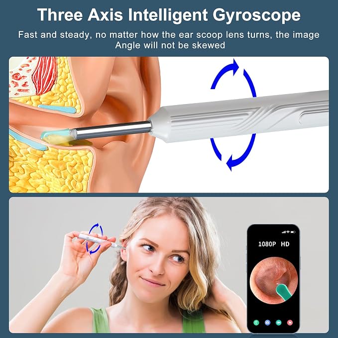 Ear Wax Removal Tool, Ear Cleaner with1080P HD Otoscope Camera, Ear Camera