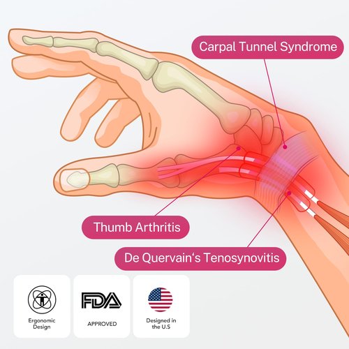 Fitomo Tri-Support Wrist Brace, Thumb Stabilizer & Palm Support - Carpal Tunnel, De Quervain's Tenosynovitis, Tendonitis, Arthritis Pain Relief, Unisex Splint (Right Hand, S/M)