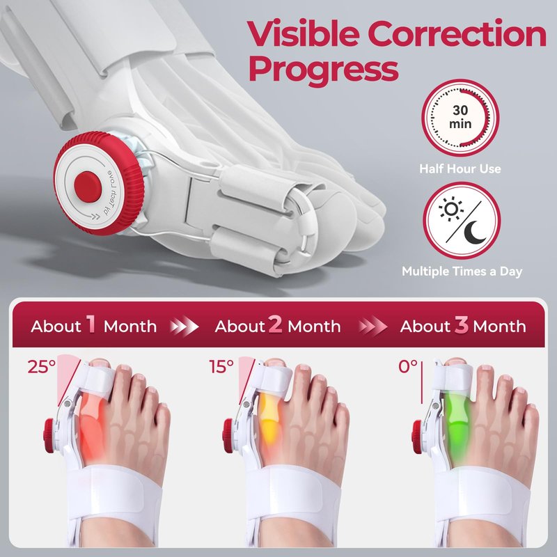 TENICORE Bunion Corrector for Kids, Adjustable Bunions Fix for Relief with Anti-slip Heel Strap, Red-1pc