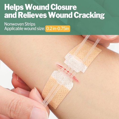 3 Types Butterfly Bandages, 28 Pack Wound Closure Strips, Emergency Laceration Closure Kit, Quick Clot Zip Stitch Wound Closures Device