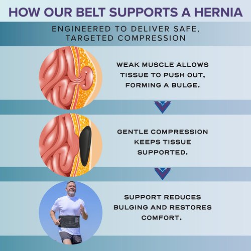 Abdomencare Umbilical Hernia Belt for Men and Women | Abdominal Hernia Belt for Women & Men with 2 Unique Compression Pads | Belly Button Umbilical Hernia Belts for Men | Hernia Support Binder | L/XL