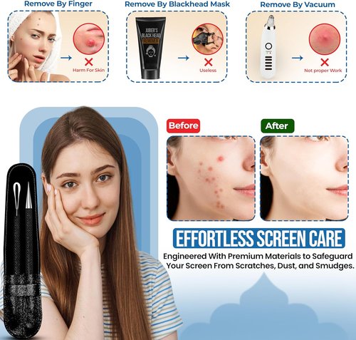 EFAH Care Stainless Steel Pimple Extractor Set - Surgical Acne Treatment Tools for Face & Nose (Black)