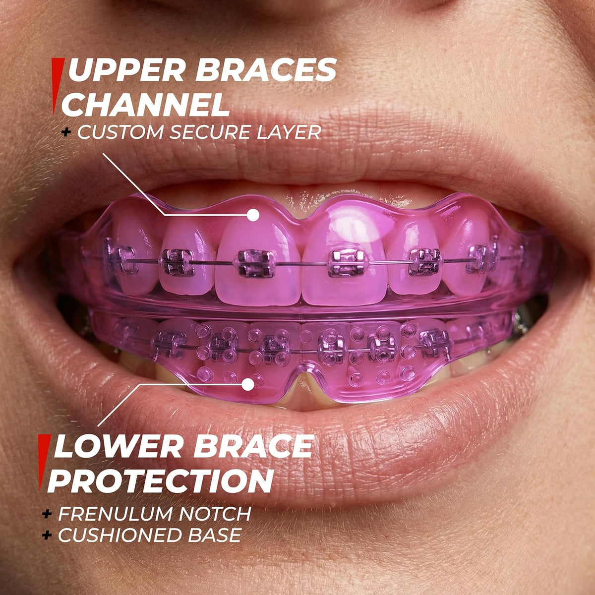 Skiennix Mouth Guard - Premium Silicone Teeth Protection for Sports | Youth & Teens (Pink, Braces-Friendly)